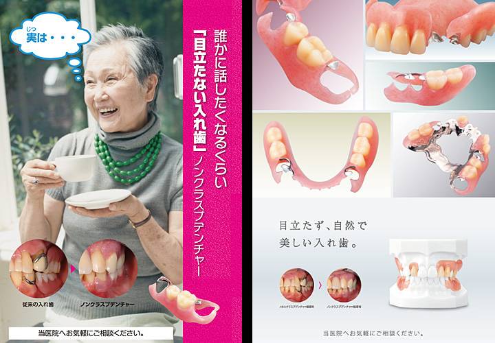 ノンクラスプデンチャー1